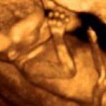Woman Laughs Before Her Ninth Abortion - Then She Sees Her Aborted Baby